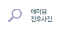 예미담 전후사진
